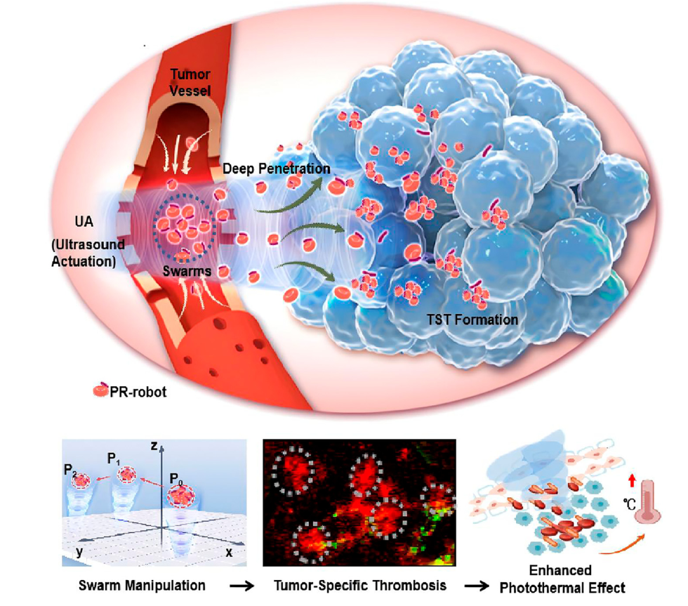 Microbial Microrobots + Ultrasound = A New Weapon Against Cancer