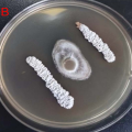 Isolation, identification, and whole-genome sequencing of Streptomyces rochei FE-3-1 against Pyricularia oryzae.